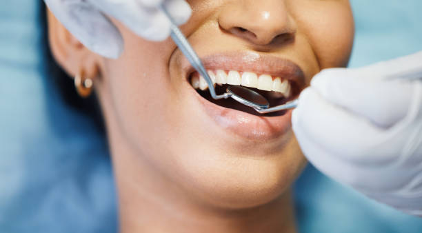 Best Chipped Tooth Repair Near Me  in Jonestown, PA